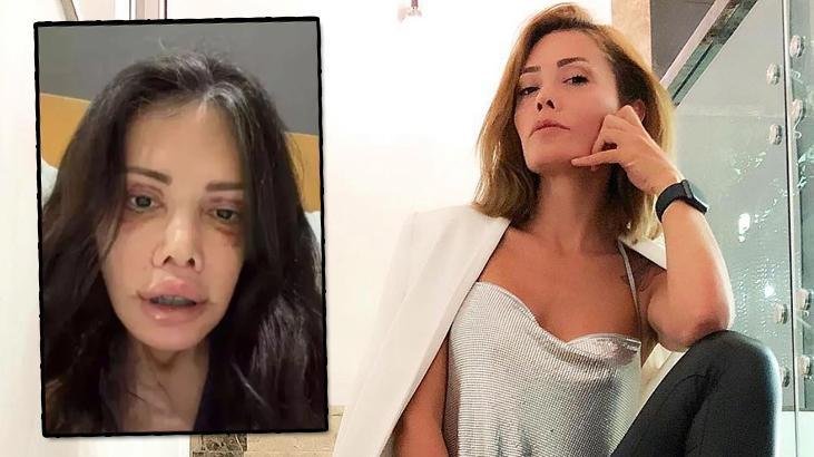 Didem Ceran'dan Şaşırtıcı Paylaşım: Yüz Nakli Olan Kişinin Alnı Kaşındı!