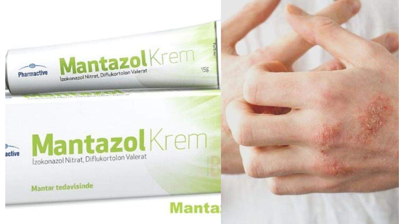 Mantazol Krem Nedir, Neden Kullanılır, Fiyatı Nedir?